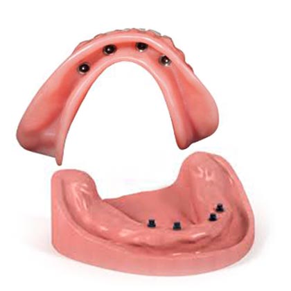 cost snap in dentures cost snap in dentures